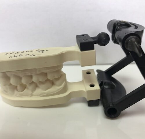 Twister Adapters on Itero Models