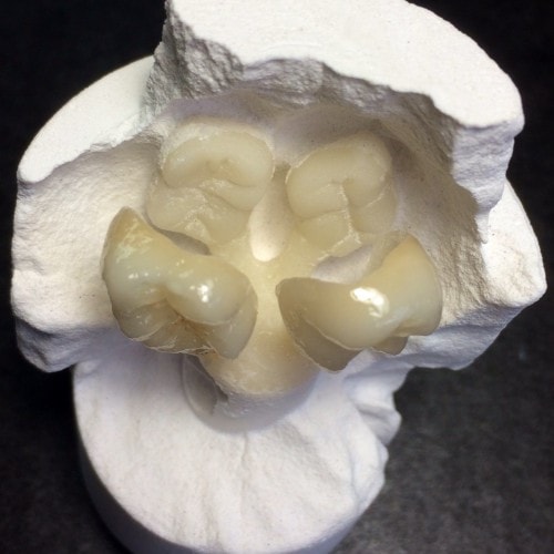 4 Molars Pressed in the 100g Super Ring