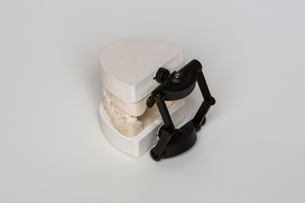 Dental articulator system in use